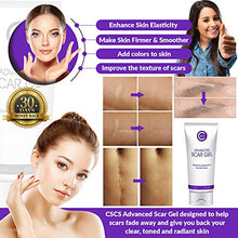 Load image into Gallery viewer, CSCS Most Effective Scar Remover Cream with Hydrolyzed Collagen & Vitamin E - Heals Old & New Scars from Cuts, Acne, Stretch Marks, Burns & Post Surgeries Scars - Fast Results, for All Skin Types 2 oz