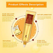 Load image into Gallery viewer, Scar Removal Cream For Old Scars- Stretch Mark Removal Gel for Men & Women- Stretch Marks Relief and Burns Repair,Face Skin Repair Gel