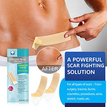 Load image into Gallery viewer, Scar Removal Patch, Scar Removal Strips Fast & Effective on Keloid, Professional Removal Sheets for Scars Caused by C-Section, Surgery, Burn, Acne, 2 Reusable Scar Sheets, 1.6"×6.5"