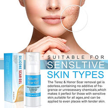Load image into Gallery viewer, Silicone Scar Gel-Kinbeau Scar Remover Gel for Face, Body, C-Section Stretch Marks, Surgical, Burn, Acne, Old & New Scars,30g/1 OZ (white blue)