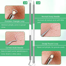 Load image into Gallery viewer, 5PCS Blackhead Remover Comedone Extractor, Curved Blackhead Tweezers Kit, Professional Stainless Pimple Acne Blemish Removal Tools Kit