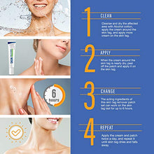 Load image into Gallery viewer, Pureskin Safe & Effective Formula Skin Tag Remover Patches Set, Skin Tag Removal Patches Set with Natural Ingredients for Your Skin Tag