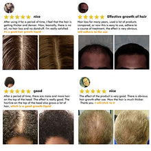 Load image into Gallery viewer, Derma Roller for Hair Growth, Biotin Hair Growth Oil Serum, Hair Scalp Massager Helps absorb Hair Growth Oil Serum, Hair Loss Treatment Kit