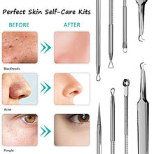 Load image into Gallery viewer, Blackhead Remover Face Mask,Black Mask,3-in-1 Purifying Charcoal Peel off Mask with Acne & Blackhead Extractor Kit and Silicone Brush,Deep Cleansing Facial Mask for All Skin Types Face & Nose