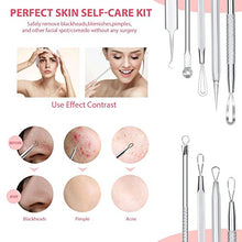 Load image into Gallery viewer, JPNK 6 PCS Blackhead Remover Comedones Extractor Acne Removal Kit for Blemish, Whitehead Popping, Zit Removing for Nose Face Tools with a Leather bag(Silver)