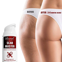 Load image into Gallery viewer, Ebanel Advanced Silicone Scar Gel, Scar Removal Cream for Old & New Scars of Acne, Surgical, C-Section, Injuries, Burn, Cuts, Insect Bites, Stretch Marks with Vitamin E, Emu Oil, Onion Extract