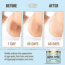 Load image into Gallery viewer, Dark Spot Remover for Face, Body and Sensitive areas - Natural Skincare for Underarms, Elbows & Privates - Made in USA - Dark Spot Corrector with Licorice, Mulberry Extract Arbutin, 1.7OZ
