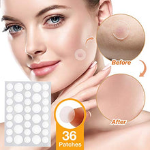 Load image into Gallery viewer, Skin Tag Remover, Skin Tag Removal Kit with 36 PCS Skin Tag Repair Patches, Efficient Skin Tag Remover Kit for Medium to Large Skin Tags