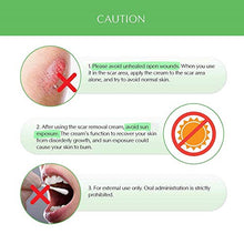 Load image into Gallery viewer, Scar Removal Cream - Advanced Treatment for Face & Body, Old & New Scars from Cuts, Stretch Marks, C-Sections & Surgeries - With Natural Herbal Extracts Formula