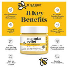 Load image into Gallery viewer, Eczema Psoriasis Cream for Dry Itchy Cracked Irritated Skin- Manuka Honey & Colloidal Oatmeal Treatment for Dermatitis, Shingles, Acne, Rosacea- Natural Anti-itch Relief for Kids, Adults, Baby Eczema