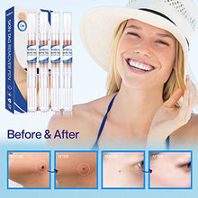 Load image into Gallery viewer, Reejoys Skin Tag & Mole Removal - Safe & Effective Formula for Skin Tag Remover (4 Packs)