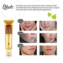 Load image into Gallery viewer, Scar Removal Cream For Old Scars- Stretch Mark Removal Gel for Men & Women- Stretch Marks Relief and Burns Repair,Face Skin Repair Gel
