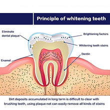 Load image into Gallery viewer, Venus Visage Teeth Whitening Pen(2 Pens), 20+ Uses, Effective&Painless, No Sensitivity, Travel-Friendly, Easy to Use, Beautiful White Smile, Natural Mint Flavor