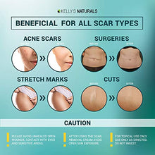 Load image into Gallery viewer, Scar Removal Cream - Effective Stretch Mark Removal - Natural Skin Repair - Acne Scar Remover Cream - Made in USA - Advanced Treatment for Old Scars & Acne Scars - Clinically Proven Formula - 2 OZ