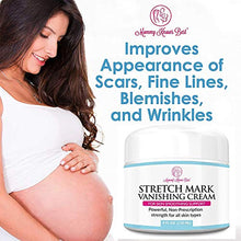 Load image into Gallery viewer, Stretch Mark Cream for Pregnancy & Scar Removal - 100% Retinol Free - Mommy Knows Best Maternity Stretch Marks Cream Removal Treatment with Cocoa and Shea Butter - Clinically Proven - 4 fl oz