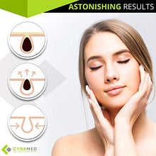 Load image into Gallery viewer, Blackhead Tweezer - Professional Curved Steel Tip Surgical Comedone & Splinter Extractor By Rapid Vitality. Ideal Blemish & Acne Remover Tool Means Flawless Facial Skin (Yellow)