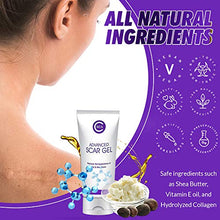 Load image into Gallery viewer, CSCS Most Effective Scar Remover Cream with Hydrolyzed Collagen & Vitamin E - Heals Old & New Scars from Cuts, Acne, Stretch Marks, Burns & Post Surgeries Scars - Fast Results, for All Skin Types 2 oz