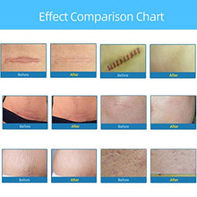 Load image into Gallery viewer, Silicone Scar Removal Sheets 5 Month Supply,Reduce C-Section Stretch Mark Acne Burn Keloid Surgery Scars,Soft Adhesive Fabric Strips, 5.9"x1.38", 5 Reusable Sheets