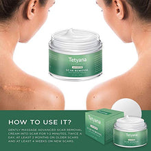 Load image into Gallery viewer, Scar Removal Cream Advanced Treatment for Old & New Scars from Cuts Stretch Marks, C-Sections & Surgeries With Natural Herbal Extracts Formula
