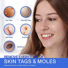 Load image into Gallery viewer, Reejoys Skin Tag & Mole Removal - Safe & Effective Formula for Skin Tag Remover (4 Packs)