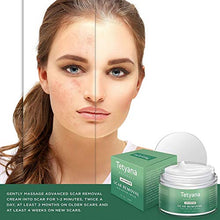 Load image into Gallery viewer, Scar Removal Cream Advanced Treatment for Old & New Scars from Cuts Stretch Marks, C-Sections & Surgeries With Natural Herbal Extracts Formula