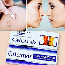 Load image into Gallery viewer, Gelcatriz Scar Treatment Gel | Scar Removal Gel for Diminishing the Visible Appearance of Acne Scars, Surgery Scars, Stretch Marks, Cuts & Scrapes, and more; 1 Ounce Tube