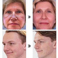 Load image into Gallery viewer, 7 Colors LED Face Mask Light Therapy, LED Light Therapy Mask Facial for Skin Rejuvenation Face Skin Care Mask