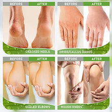 Load image into Gallery viewer, Urea 42% Foot Cream, Foot Repair Cream with Useful Callus Remover Tool for Dry Cracked Heels and Rough, Calloused Feet, Urea Moisturizing Cream for Men and Women 3.5oz