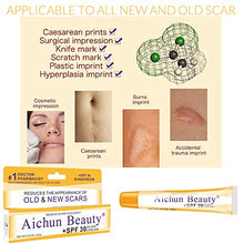 Load image into Gallery viewer, Scar Removal Cream For New & Old Scars Stretch Mark Removal Surgery,Burn Marks Relief. advanced scar gel Acne Scars,