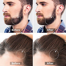 Load image into Gallery viewer, Derma Roller Microneedle Roller for Face Body Beard Hair Growth, 540 Titanium Micro Needles Roller for Home Use