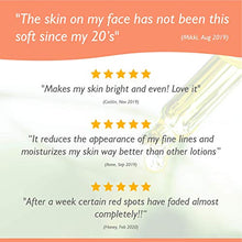 Load image into Gallery viewer, Teddie Organics Rosehip Seed Oil for Face, Hair and Skin 1oz, Pure Rose Hip Oil (Works as a Carrier and Facial Oil)