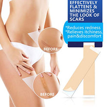 Load image into Gallery viewer, Scar Removal Patch, Scar Removal Strips Fast & Effective on Keloid, Professional Removal Sheets for Scars Caused by C-Section, Surgery, Burn, Acne, 2 Reusable Scar Sheets, 1.6"×6.5"