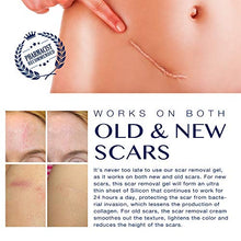 Load image into Gallery viewer, Scar Remover Gel for Scars from C-Section, Stretch Marks, Acne, Surgery, Effective for both Old and New Scars