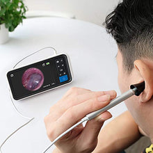 Load image into Gallery viewer, Digital Otoscope with 4.5 Inches Screen, Anykit 3.9mm Ear Camera with 6 LED Lights, 32GB Card, Ear Wax Removal Tool, Specula and 2500 mAh Rechargeable Battery, Supports Photo Snap and Video Recording