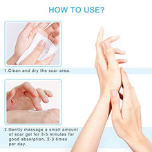 Load image into Gallery viewer, Silicone Scar Gel-Kinbeau Scar Remover Gel for Face, Body, C-Section Stretch Marks, Surgical, Burn, Acne, Old & New Scars,30g/1 OZ (white blue)