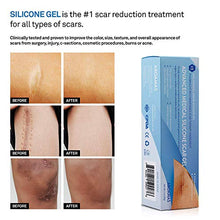 Load image into Gallery viewer, Aroamas Advanced Scar Gel Medical-Grade Silicone for Face, Body, Stretch Marks, C-Sections, Surgical, Burn, Acne, Old & New Scars, Clinically Proven, 30g