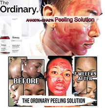Load image into Gallery viewer, THE ORDINARY AHA 30% + BHA 2% PEELING SOLUTION 30ML
