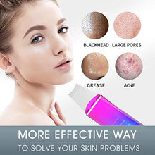 Load image into Gallery viewer, Skin Scrubber Face Spatula, JOYJULY Facial Cleansing Scraper Peel Pores Cleanser,Blackhead Removal Acne Extractor Skin Exfoliation Colorful