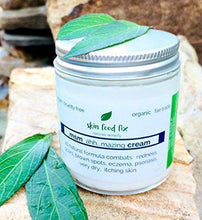 Load image into Gallery viewer, MSM Cream Rosacea Eczema Psoriasis Scars