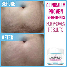 Load image into Gallery viewer, Stretch Mark Cream for Pregnancy & Scar Removal - 100% Retinol Free - Mommy Knows Best Maternity Stretch Marks Cream Removal Treatment with Cocoa and Shea Butter - Clinically Proven - 4 fl oz