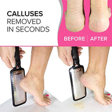 Load image into Gallery viewer, Genuine feet scrubber dead skin remover for feet (Large) Foot file callus remover foot scrubber dead skin remover foot rasp - Heel scraper for feet foot file for dead skin foot grater for dead skin