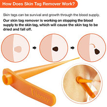 Load image into Gallery viewer, Skin Tag Remover, Skin Tag Removal Kit with 36 PCS Skin Tag Repair Patches, Efficient Skin Tag Remover Kit for Medium to Large Skin Tags