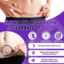 Load image into Gallery viewer, CSCS Most Effective Scar Remover Cream with Hydrolyzed Collagen & Vitamin E - Heals Old & New Scars from Cuts, Acne, Stretch Marks, Burns & Post Surgeries Scars - Fast Results, for All Skin Types 2 oz