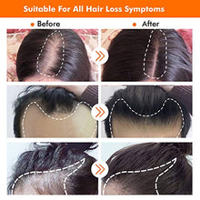 Load image into Gallery viewer, Derma Roller for Hair Growth, Biotin Hair Growth Oil Serum, Hair Scalp Massager Helps absorb Hair Growth Oil Serum, Hair Loss Treatment Kit