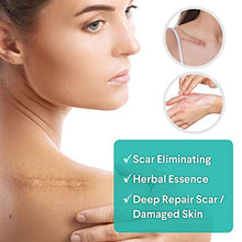 Load image into Gallery viewer, Scar Removal Cream, Scar Cream For Old Scars - Stretch Mark Removal Cream for Men & Women - Stretch Marks Relief and Burns Repair, Face Skin Repair Cream