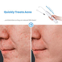Load image into Gallery viewer, NuDerma Portable Handheld High Frequency Skin Therapy Wand Machine w/Neon - Acne Treatment - Skin Tightening - Wrinkle Reducing - Dark Circles - Puffy Eyes - Hair Follicle Stimulator