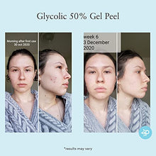 Load image into Gallery viewer, Glycolic Acid 50% Gel Peel - Enhanced with Retinol & Green Tea Extract (Professional Skin Peel)1 ounce
