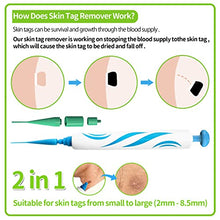 Load image into Gallery viewer, 2 in 1 Skin Tag Remover - Auto Skin Tag Remover Pen Removal Kit Products Tool with 40 Micro and Regular Skin Tag Bands, User-Friendly, Safe and Painless Remove Small to Large (2mm-8mm) Sized Skin Tag