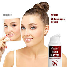 Load image into Gallery viewer, Ebanel Advanced Silicone Scar Gel, Scar Removal Cream for Old & New Scars of Acne, Surgical, C-Section, Injuries, Burn, Cuts, Insect Bites, Stretch Marks with Vitamin E, Emu Oil, Onion Extract