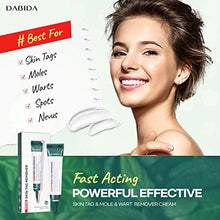 Load image into Gallery viewer, Skin Tag Remover Cream for Safe & Effective Skin Tag Removal, Natural Ingredients, Korean Skin Care